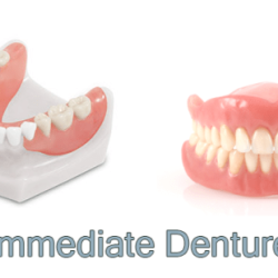 Maxillary landmarks